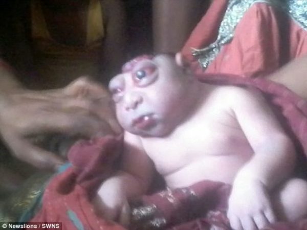 The baby branded an ALIEN: Mother refused to breastfeed ...