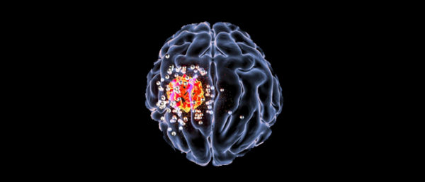 New drug shows promise in halting spread of brain cancer | Clamor World